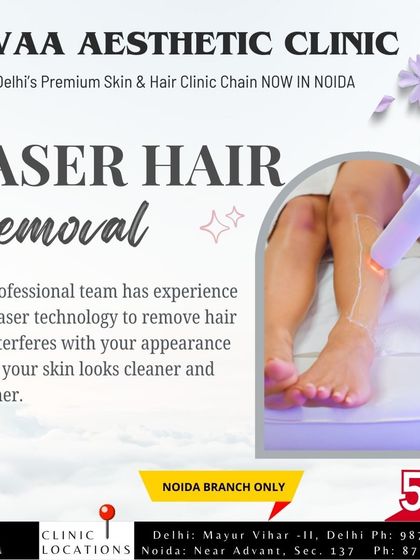 A special 50% off promotion for laser hair removal, exclusive to our Noida branch. Our professional team uses advanced technology for clean, smooth skin.
