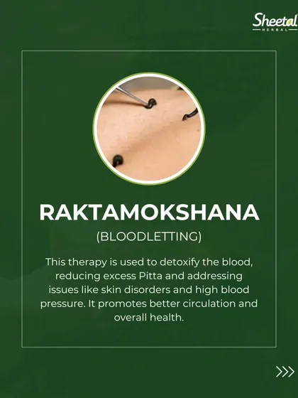 Raktamokshana is a traditional blood purification therapy, often performed using medicinal leeches as seen here. This process detoxifies the blood by removing impurities, which is particularly effective for stubborn skin disorders, reducing excess Pitta, and improving circulation.
