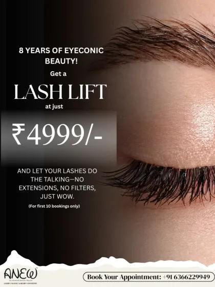 For our 8th anniversary, get an eyeconic lash lift for just ₹4999. Let your natural lashes do the talking, no extensions or filters needed.