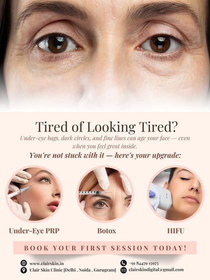 Tired of looking tired? We offer a range of solutions to rejuvenate the eye area. This graphic showcases our top treatments, including Under-Eye PRP, Botox to soften crow's feet, and HIFU for skin tightening, all designed to restore a youthful, awake look.