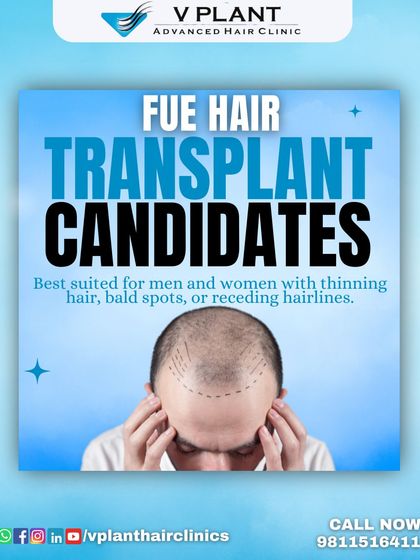 Are you a good candidate for an FUE hair transplant? This graphic explains that the procedure is best suited for men and women with thinning hair, bald spots, or receding hairlines.
