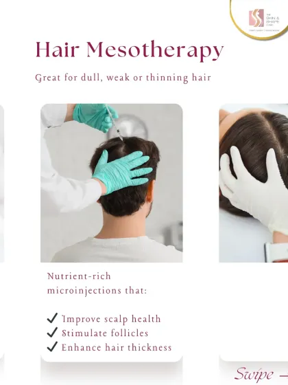 Hair Mesotherapy is an excellent option for dull, weak, or thinning hair. The treatment involves nutrient-rich microinjections that improve scalp health, stimulate follicles, and enhance hair thickness.