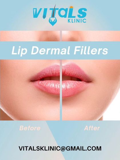 Vitals Klinic - Aesthetic Dermatology Anti-Aging & Facial Contouring photo 7