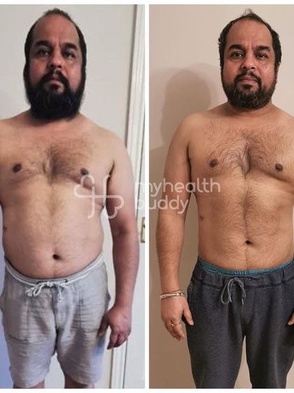 Vikas lost 8 kgs in 3 months and improved his type 2 diabetes management by correcting the flaws in his "healthy" diet.