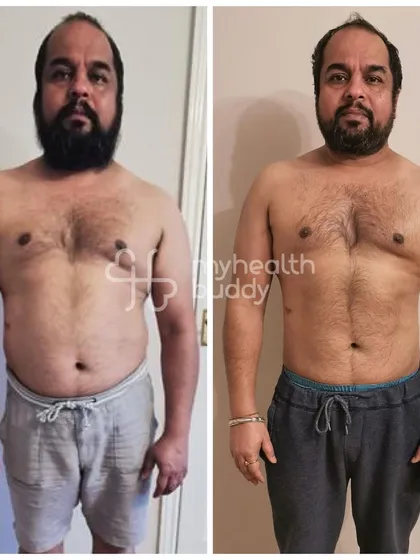 A front view of Vikas's transformation. His journey shows how a structured diet and exercise plan can have a massive impact on managing metabolic conditions.