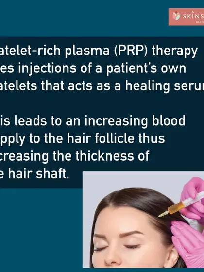 This graphic explains the science behind Platelet Rich Plasma (PRP) therapy. We use a concentration of your own blood platelets, creating a powerful healing serum. When injected into the scalp, it increases blood supply to the hair follicles, which helps thicken the hair shaft and promote new growth.