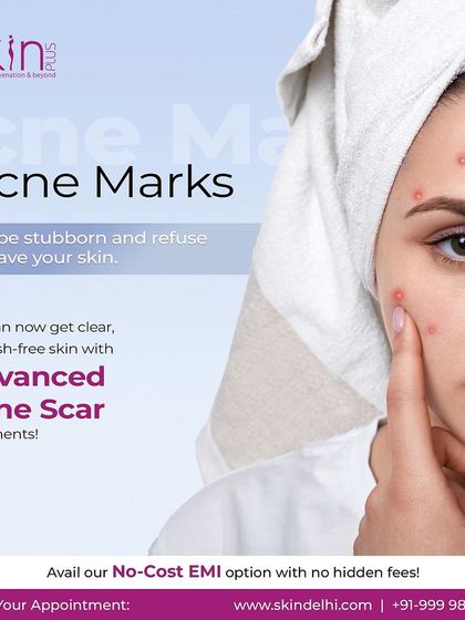 Acne, Pores & Scar Correction photo 19