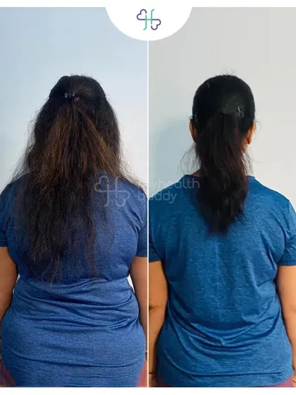 Rashmi's back transformation after losing 15 kgs in 12 weeks. This view shows a significant change in her overall body shape and posture.