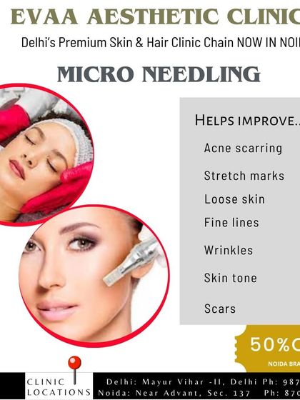 This graphic lists the issues that Microneedling helps improve, such as acne scarring, stretch marks, loose skin, fine lines, and uneven skin tone.
