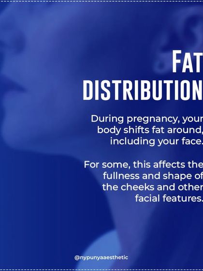 During pregnancy, your body shifts fat around to nourish the baby, which can affect the fullness of your cheeks and jawline. These changes are a normal part of the process.