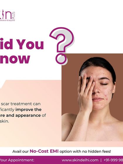 Collagen Boosting: Microneedling & PRP photo 19