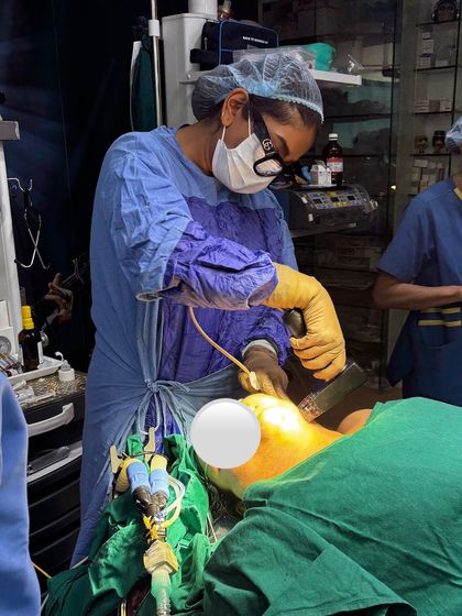 In this image, I am focused on performing a FaceTite procedure. This technology is excellent for patients looking for noticeable skin tightening and fat reduction in the neck and jawline area without major surgery.