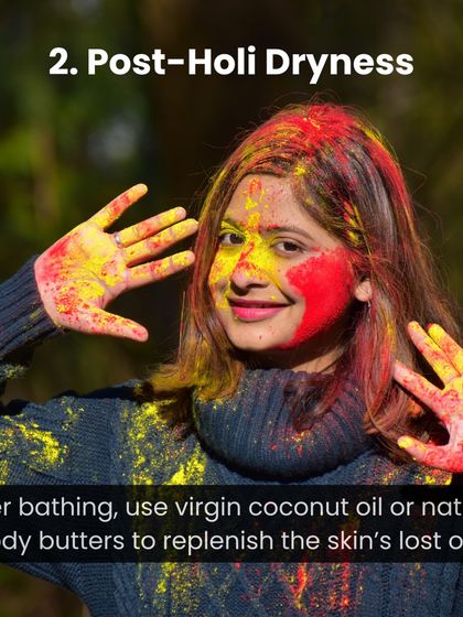 How to handle post-Holi dryness. After bathing, use virgin coconut oil or natural body butters to replenish the skin's lost oils.