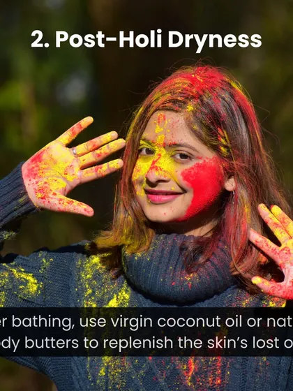 How to handle post-Holi dryness. After bathing, use virgin coconut oil or natural body butters to replenish the skin's lost oils.
