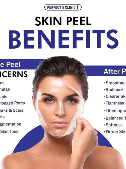 This graphic shows the comprehensive benefits of a skin peel. It addresses concerns like fine lines, sun damage, and clogged pores, resulting in smoother, clearer, and firmer skin.