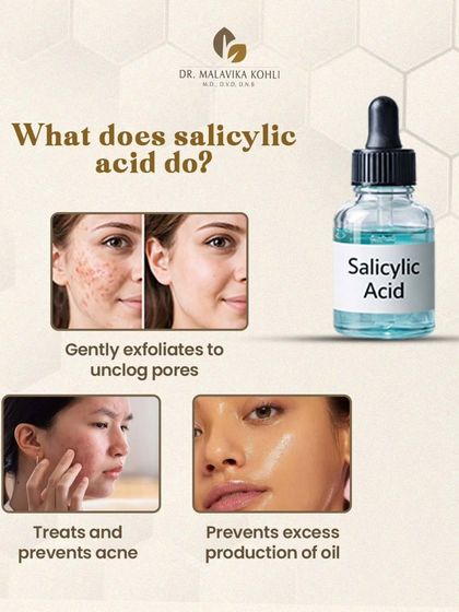 Salicylic Acid, a Beta Hydroxy Acid (BHA), is a cornerstone ingredient for treating oily and acne-prone skin. Its oil-soluble nature allows it to penetrate pores and exfoliate from within, effectively dissolving the debris that leads to comedones and inflammation.