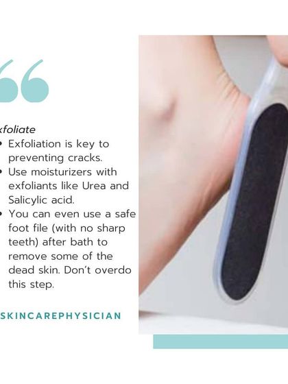 Gentle exfoliation is key. You can use a foot file on damp skin after a bath, but don't overdo it. The primary goal is to remove dead skin without causing irritation.