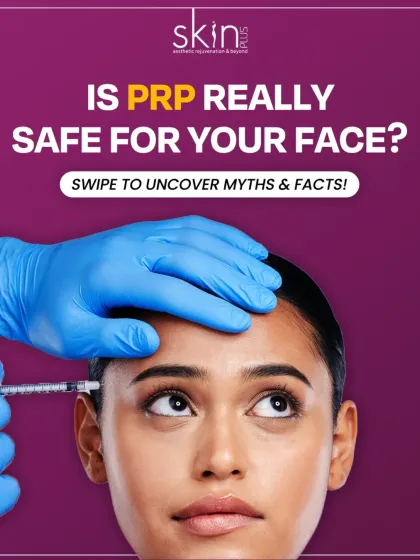 Collagen Boosting: Microneedling & PRP photo 3