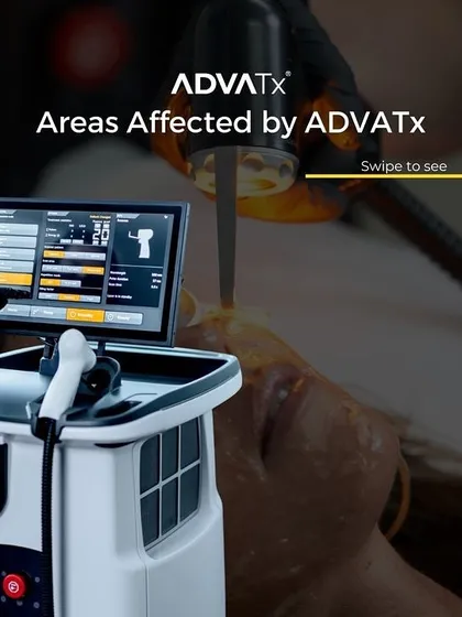 This graphic illustrates the areas affected by the AdvaTx laser. Its dual-wavelength technology allows it to treat both superficial issues in the epidermis and deeper concerns in the dermis for comprehensive skin restoration.