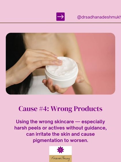 Using the wrong skincare products, especially harsh peels or active ingredients without professional guidance, can irritate the skin. This irritation can cause inflammation and make pigmentation worse.