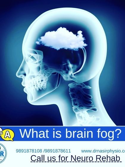 What is brain fog? It's a feeling of slow thinking, confusion, and lack of focus that can be a symptom of conditions like Craniocervical Instability. Our neuro-rehab programs can help address the underlying physical causes.