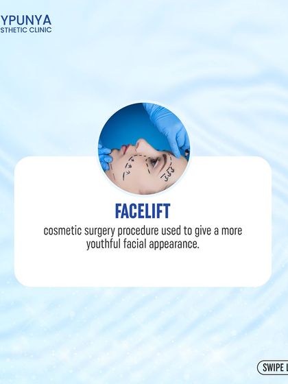 A facelift, or rhytidectomy, is a cosmetic surgery procedure used to give a more youthful facial appearance by tightening the skin on the face and neck.