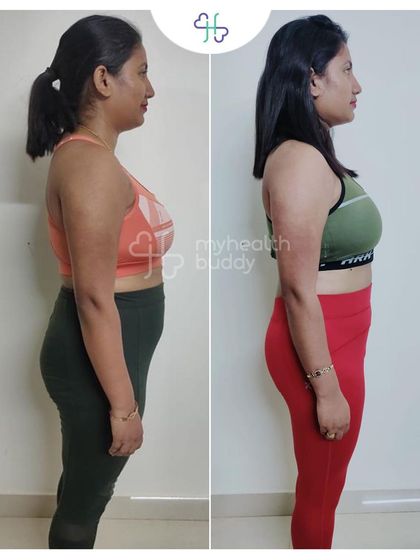 Side view of Sangita's progress.