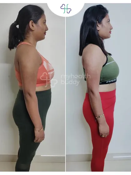 Side view of Sangita's progress.