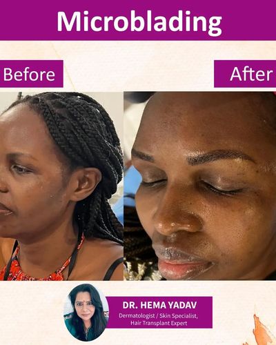 Permanent & Semi-Permanent Makeup