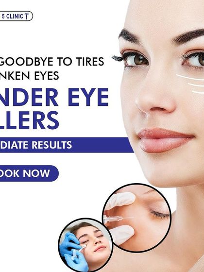 Say goodbye to tired and sunken eyes with our under-eye filler treatment. This graphic shows how we provide immediate results, restoring volume and vitality to the delicate under-eye area.