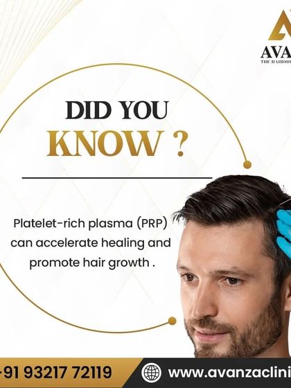 Did you know that Platelet-Rich Plasma (PRP) can accelerate healing and promote hair growth? This informative graphic shows a doctor administering the treatment, which is a key part of our hair restoration process.