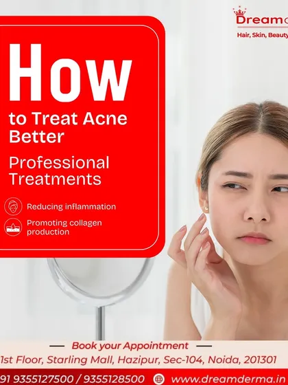 Professional treatments are the best way to manage acne effectively. Our methods focus on reducing inflammation and promoting collagen production to not only clear existing acne but also heal the skin and prevent scarring.