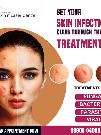 My clinic provides the best treatment for a range of skin infections, including fungal, bacterial, parasitic, and viral types. This graphic highlights the comprehensive care I offer to clear up these irritating and often persistent conditions.