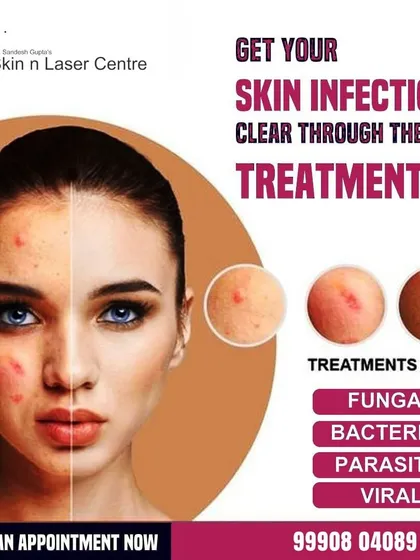 My clinic provides the best treatment for a range of skin infections, including fungal, bacterial, parasitic, and viral types. This graphic highlights the comprehensive care I offer to clear up these irritating and often persistent conditions.