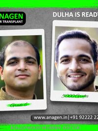 Hair Loss Consultation & Management