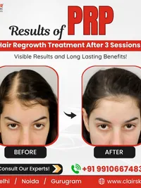 Hair Loss Treatment