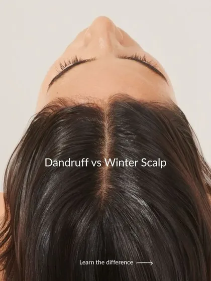 Is it dandruff or just a dry, "winter scalp"? Understanding the difference is the first step to effective treatment. We help you diagnose the specific cause of flaking and irritation to find the right solution for your scalp's health.