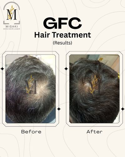 Hair Restoration