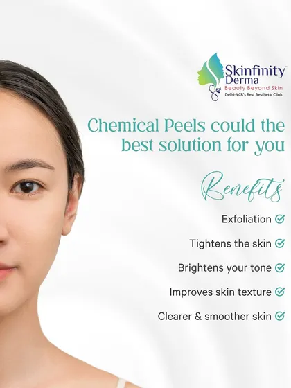 Chemical peels are an excellent solution for acne scars, pigmentation, and uneven skin tone. By exfoliating the outer layers of skin, they encourage cell turnover, revealing fresher, brighter, and smoother skin underneath.