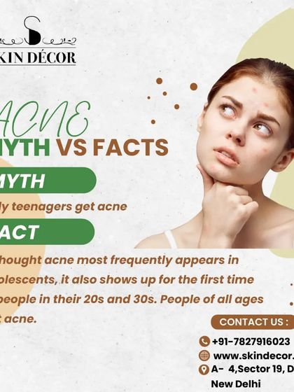 A common myth is that only teenagers get acne. The fact is, people of all ages can experience breakouts, with many seeing acne for the first time in their 20s and 30s. Adult acne is very real and requires a different approach than teenage acne.