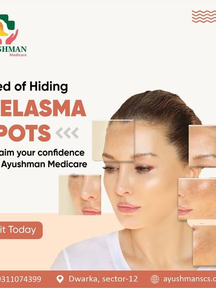 Tired of hiding melasma spots? We offer specialized treatments to manage this challenging condition, helping you reclaim your confidence with a clearer and more even complexion.