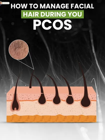 Facial hair is a common concern with PCOS. This infographic explains how to manage it naturally by focusing on diet and lifestyle.