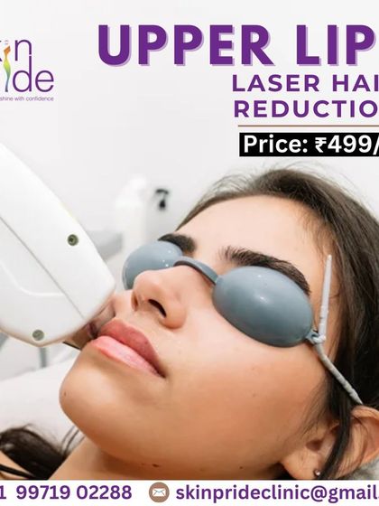Get a permanent solution for unwanted upper lip hair for only ₹499. Our laser treatment is fast, safe, and effective, giving you smooth skin in just a few minutes.