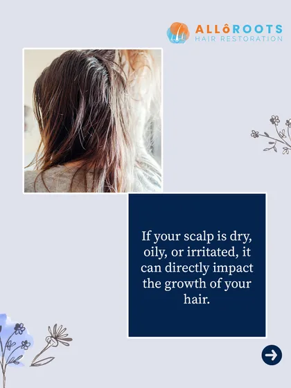 An irritated scalp, whether it's too dry or too oily, can directly impact the growth and health of your hair. Addressing scalp issues is the first step toward stronger hair.