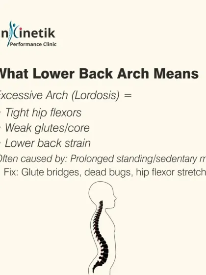 An excessive lower back arch, or lordosis, often indicates tight hip flexors and weak glutes and core muscles. I recommend glute bridges, dead bugs, and hip flexor stretches to correct this postural issue.