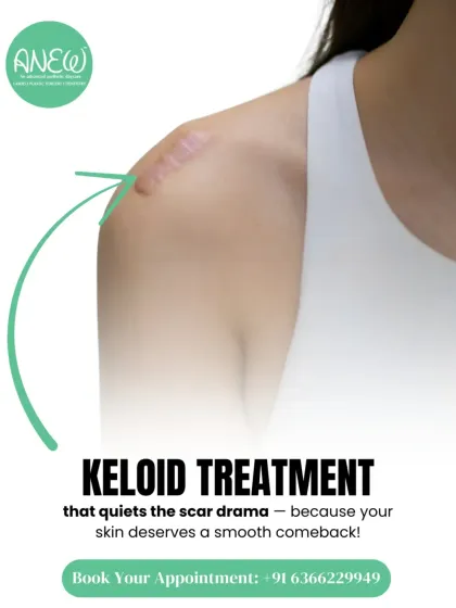 Our keloid treatment is designed to quiet the scar drama. We use targeted therapies to make raised scars smoother, flatter, and less visible, helping your skin make a smooth comeback.