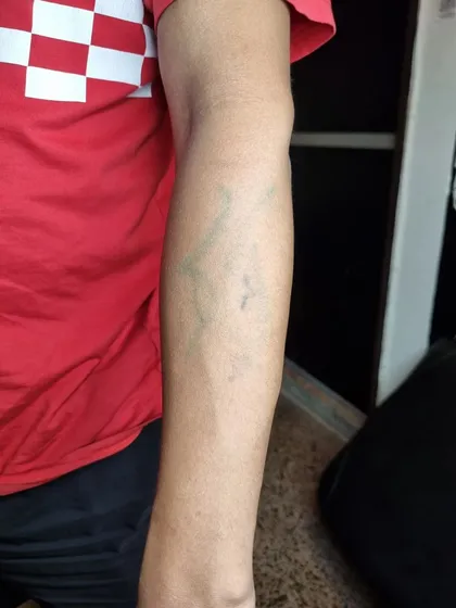 This is the 'before' photo, showing the faint, greenish old tattoo on the forearm that was completely covered by the new dragon design.