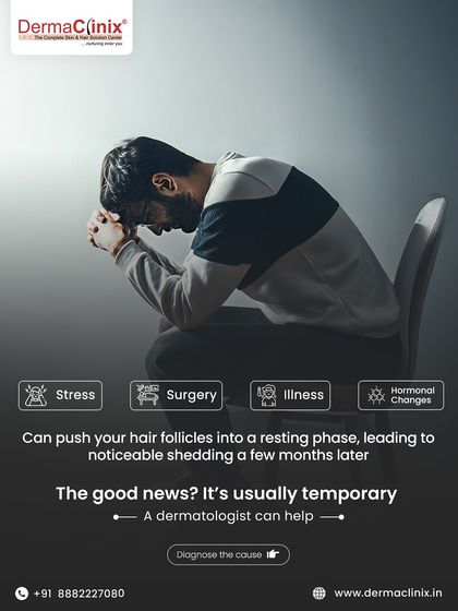 This infographic shows the common triggers for Telogen Effluvium, such as stress, surgery, illness, or hormonal changes. The good news is that it's usually temporary with the right medical help.