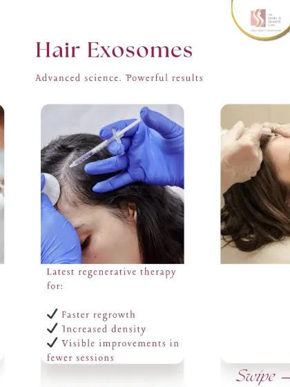 Hair Exosomes are a powerful regenerative therapy for faster regrowth and increased hair density. Many clients see visible improvements in fewer sessions compared to other treatments.