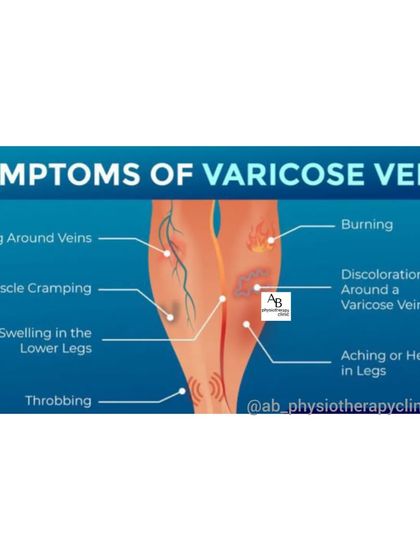 Varicose veins are more than just a cosmetic issue. Here, we outline the common symptoms, such as itching, muscle cramping, swelling, and a feeling of heaviness in the legs, which indicate a need for assessment.